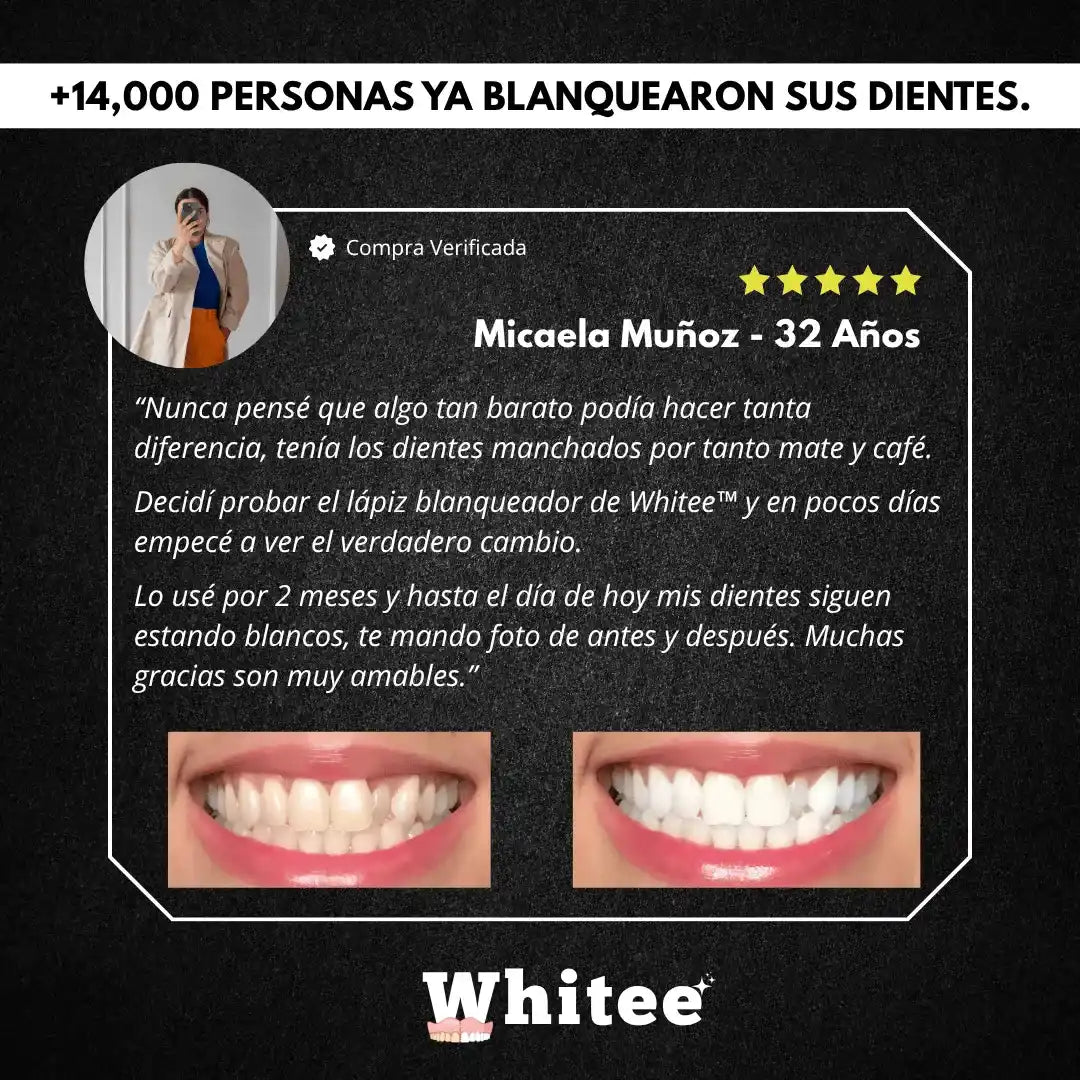 Combo Blanqueador Dental Whitee™