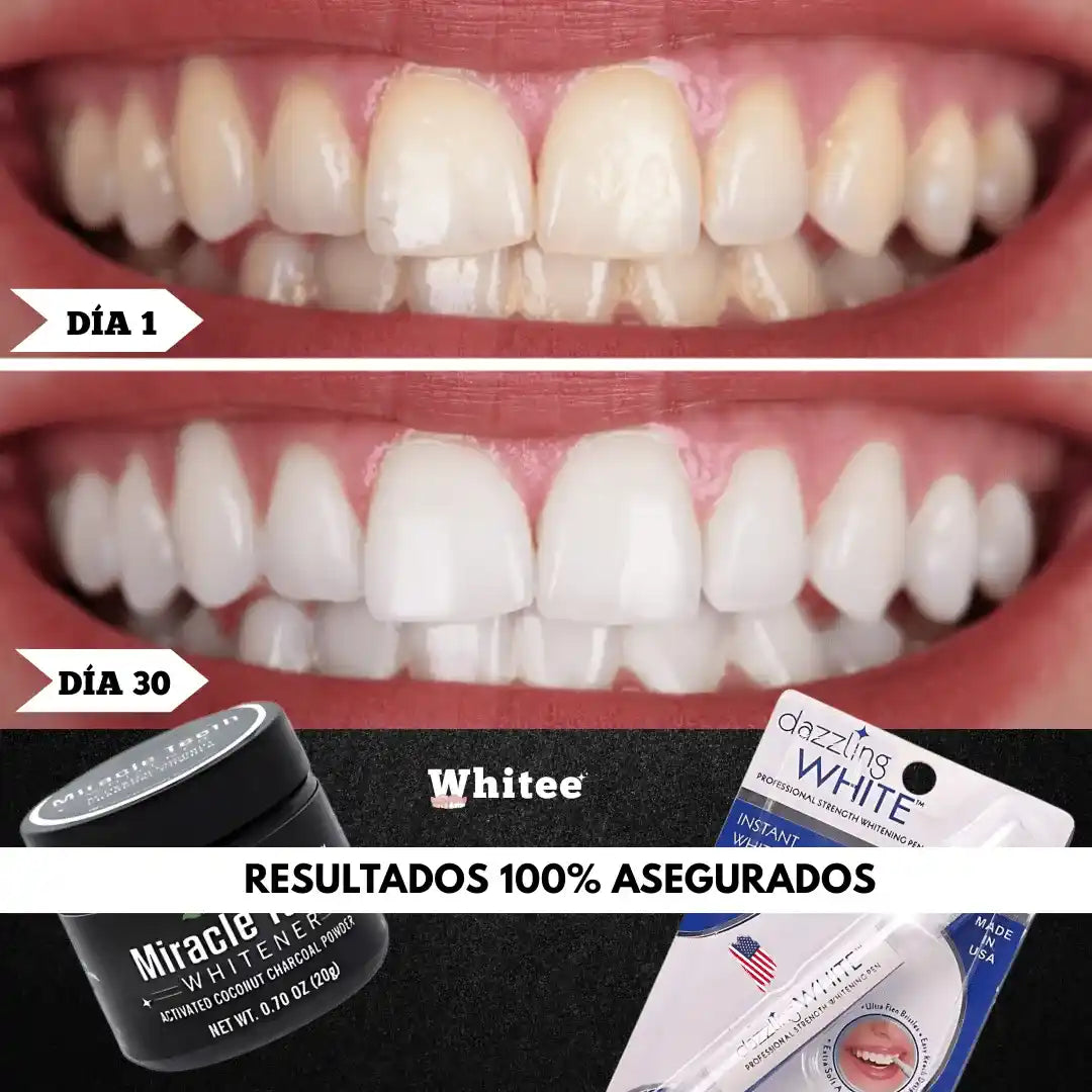 Combo Blanqueador Dental Whitee™