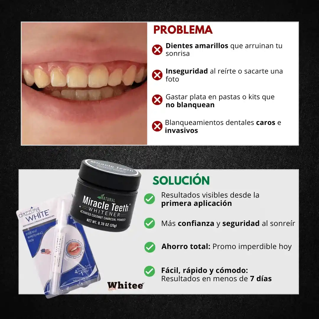 Combo Blanqueador Dental Whitee™