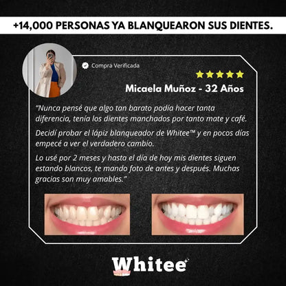 Combo Blanqueador Dental Whitee™