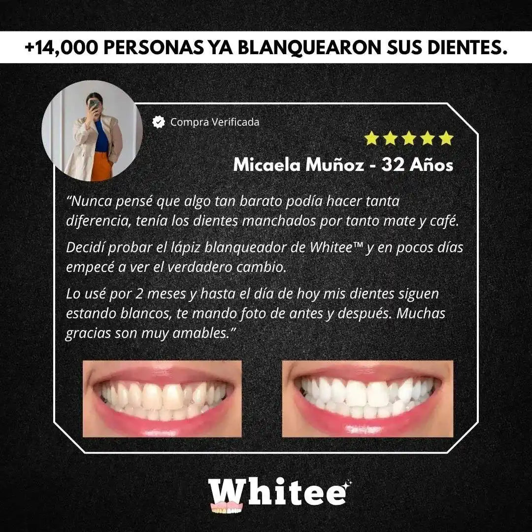 Lápiz Blanqueador Dental Whitee™