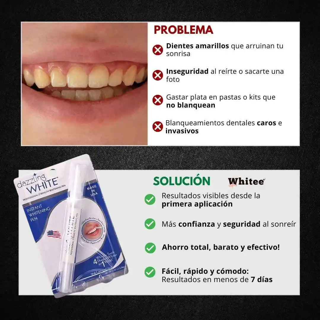 Lápiz Blanqueador Dental Whitee™