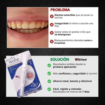 Lápiz Blanqueador Dental Whitee™