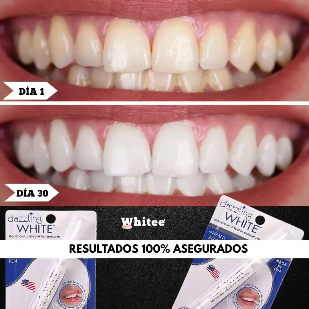 Lápiz Blanqueador Dental Whitee™